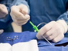Cateterismo: precisión diagnóstica para la salud del corazón