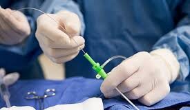 Cateterismo: precisión diagnóstica para la salud del corazón
