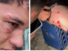 Herido menor de edad tras una tángana en vacacional de fútbol en Barinas